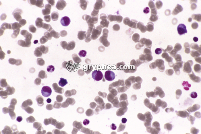 Moelle osseuse x200 - gryphea.org